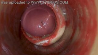 Camera Inside Deep Pussy Captures Huge Ejaculation of Sperm ASMR